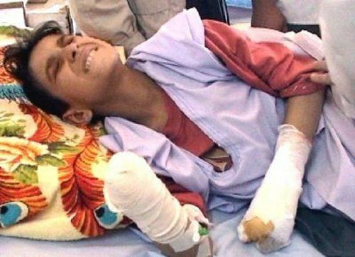 米軍が投下したクラスター爆弾で負傷、苦しむイラクの少年