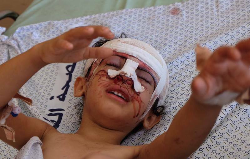 イスラエル軍の空爆で負傷したガザの少女