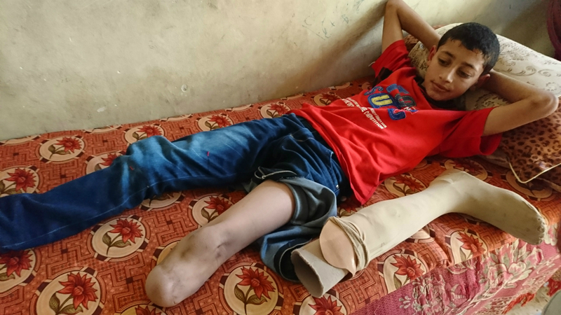 イブラヒムくんは2014年のガザ攻撃で左足を失った。CCP提供