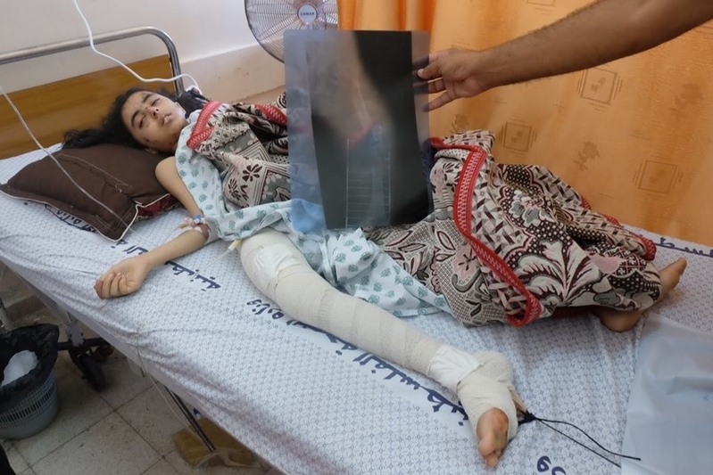 イスラエル軍の攻撃で負傷したガザの少女（2014年、筆者撮影）