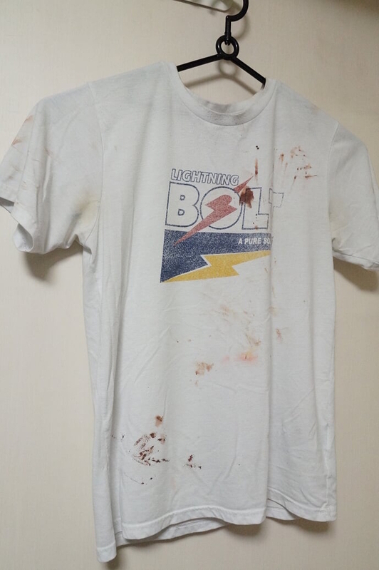 自殺未遂で血が付着したデニズさんのTシャツ　樫田氏提供