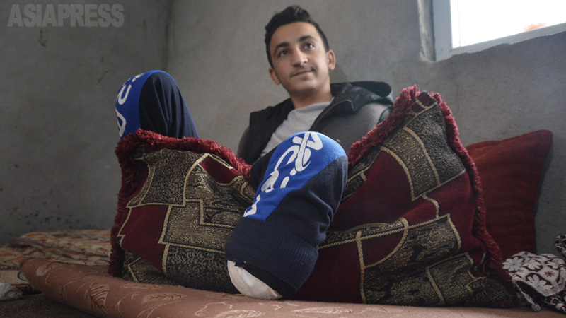 バグーズでの爆撃で左足を失ったフアッド。シリア民主軍が拘束、ヤズディ教徒だったことがわかり、イラク・クルド自治区の母のもとに戻れた。（2019年11月・玉本英子撮影）
