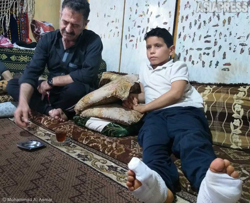 アハマドさん（左）は頭と手に傷を負い、息子（右）は頭蓋骨損傷と足を負傷。「なぜ市民が犠牲に」とアハマドさんは話す。（2021年12月、シリア・イドリブ・撮影：ムハンマド・アル・アスマール）