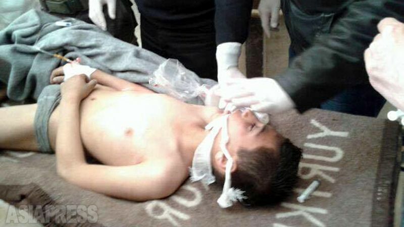【シリア】 ハーンシェイフンでの攻撃直後、病院で応急処置を受ける子ども。英BBCは「2013年9月以降、少なくとも106回の化学兵器攻撃がシリアで行われたことを示す証拠がある」と報じている。（2017年４月・イドリブ近郊の病院で医師撮影）