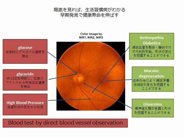 図1　眼底検査は多くの生活習慣病がわかる　出典：ナノルクス