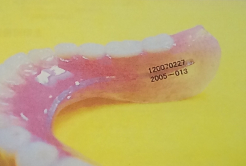 歯科医師と患者のIDナンバーを記載した義歯刻印法（千葉県歯科医師会提供）