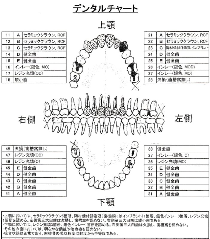 身元不明遺体の歯の状態が記録されるデンタルチャート（斉藤氏提供）