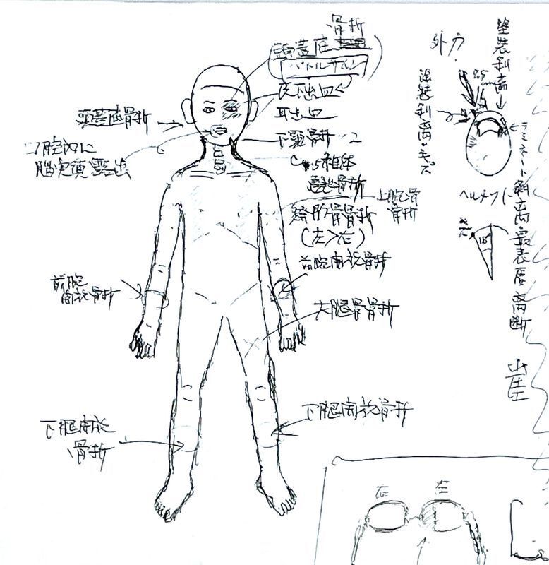 父親で外科医の緒方さんによる当日のメモ（筆者撮影）